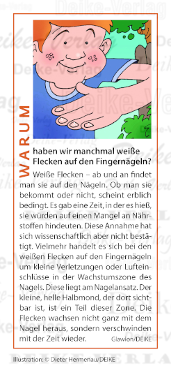 Warum haben wir manchmal weiße Flecken auf den Fingernägeln?